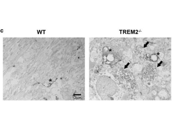 Immuno-electron microscopy using biotinylated anti-rabbit and streptavidin-HRP